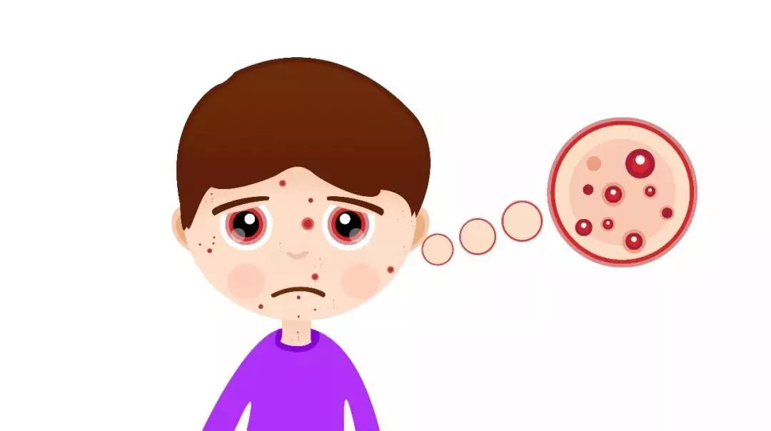 南京皮肤医院得了湿疹会有哪些症状表现呢?