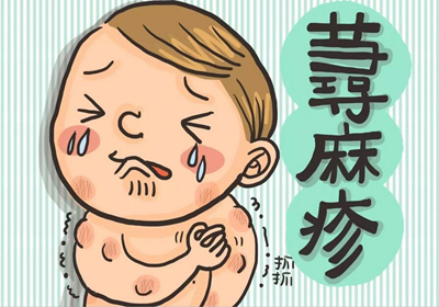 南京肤康皮肤医院荨麻疹有什么特点？